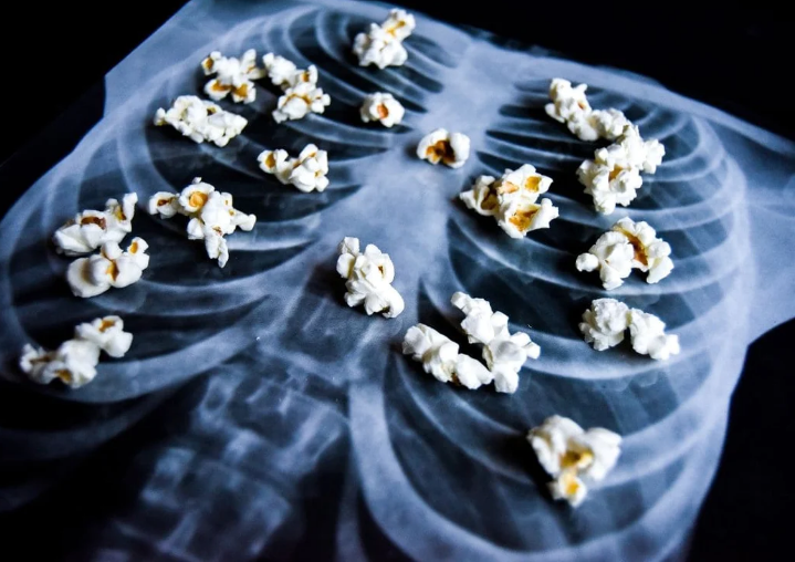 Does Diacetyl In Vaping Cause Popcorn Lung