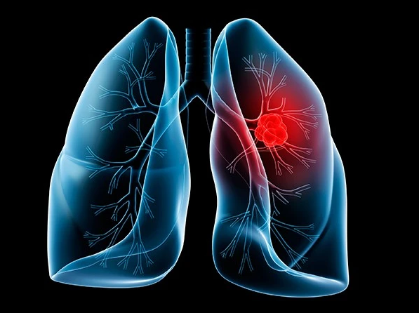 Can your lungs heal if you quit smoking