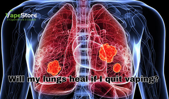 Will my lungs heal if I quit vaping