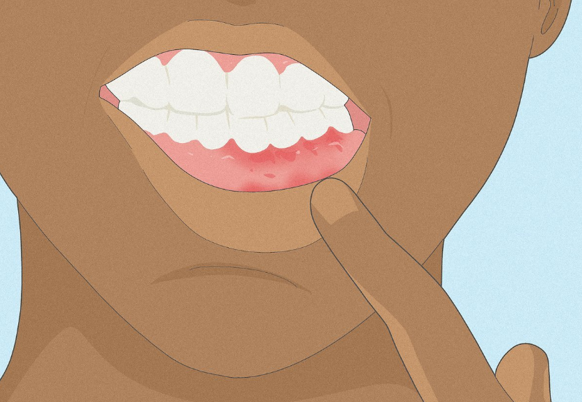 How do I stop vaping from ruining my teeth