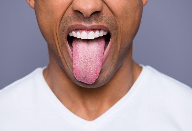 What Vape tongue